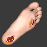 diabetic-foot-care-featured