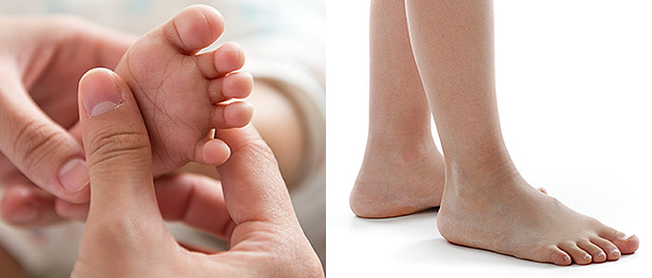 Kids can develop foot problems too!  Don't delay seeking for help from a specialist if you notice any abnormalities or if your child complains of foot pain.