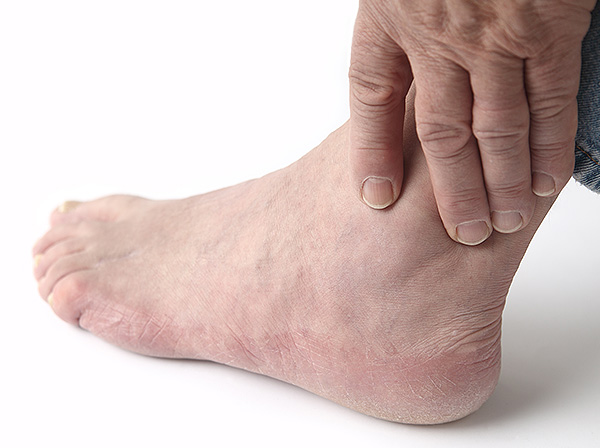 People with diabetes may be at risk for foot-related complications.